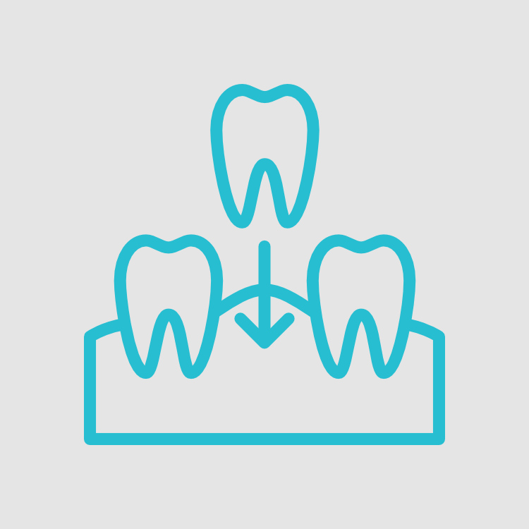 No tratamento de Dentes em um Dia é feito um estudo pormenorizado do caso clínico, com recurso às novas tecnologias e radiografias disponíveis, e encontrada a solução adaptada ao mesmo.