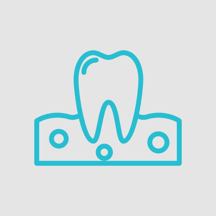 doenças das gengivas periodontologia