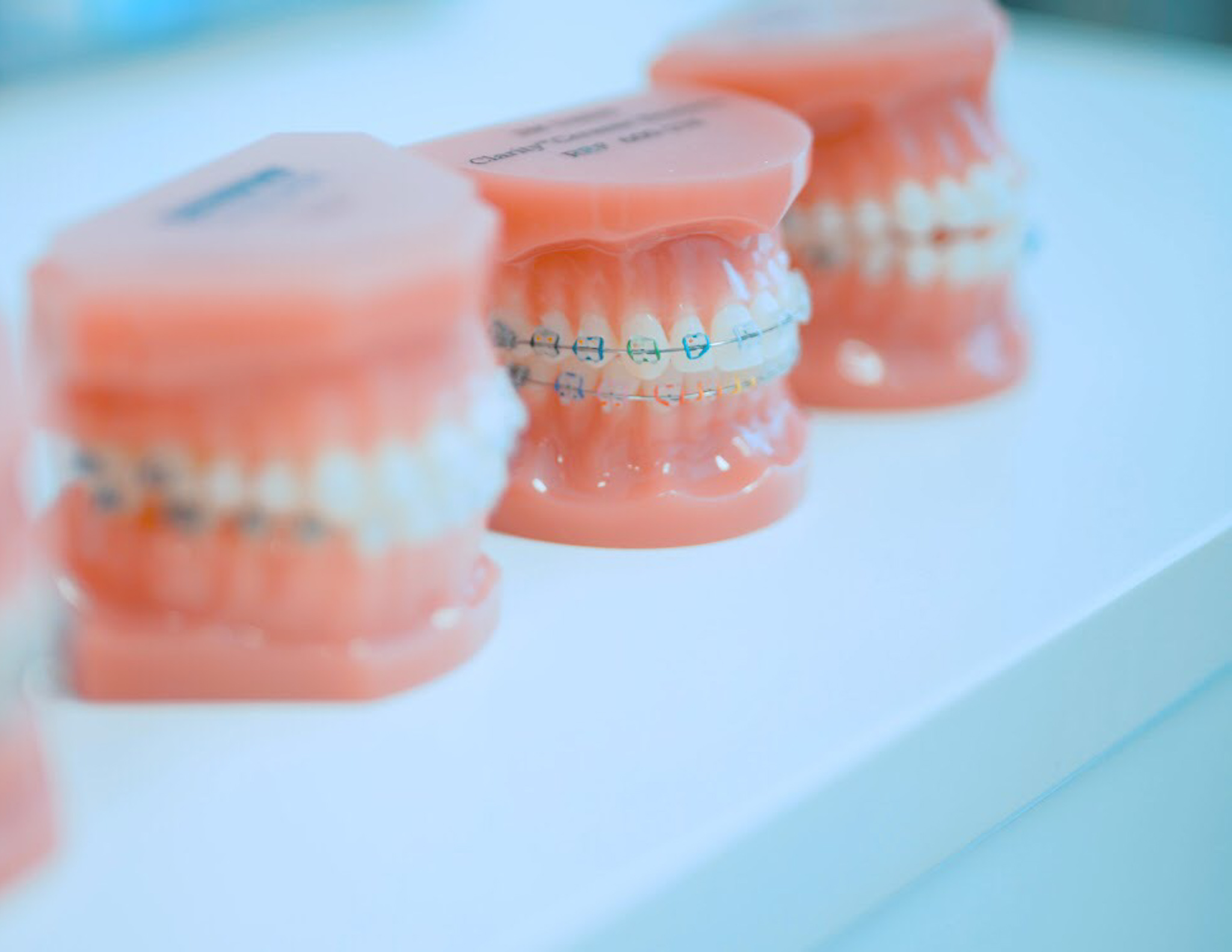 Tipos de aparelhos dentários
