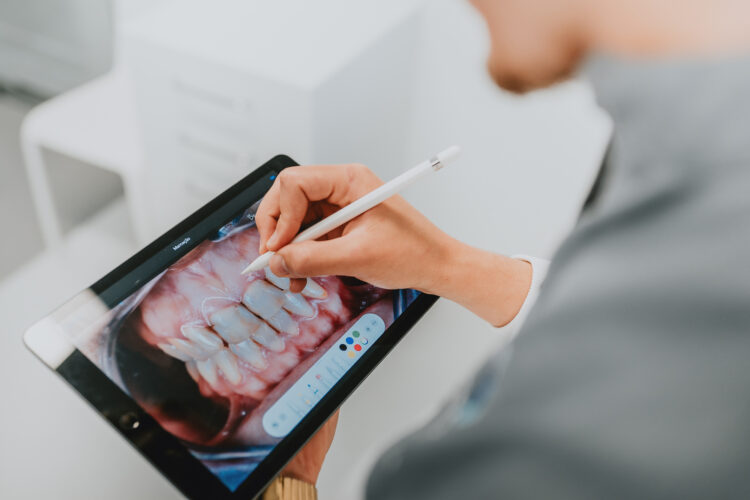 Branqueamento Dentário – 7 Questões Que Deve Saber