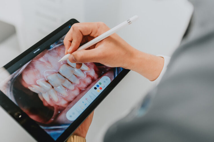 O branqueamento dentário, resume-se ao ato de clarear os dentes, de forma a obter um tom mais claro e homogéneo.