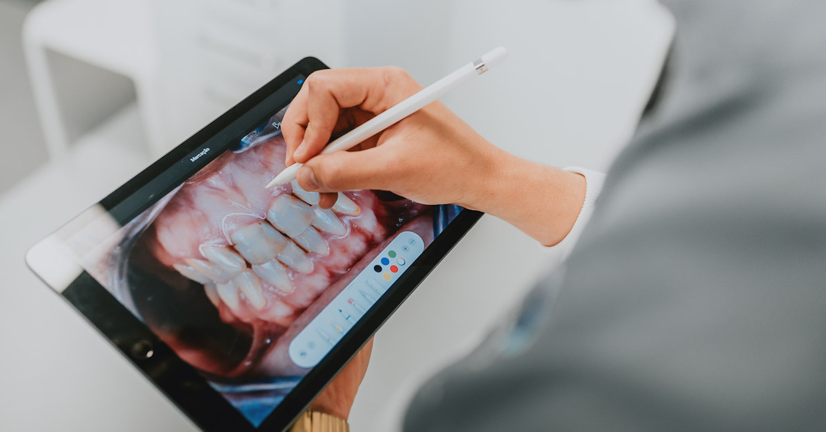O branqueamento dentário, resume-se ao ato de clarear os dentes, de forma a obter um tom mais claro e homogéneo.