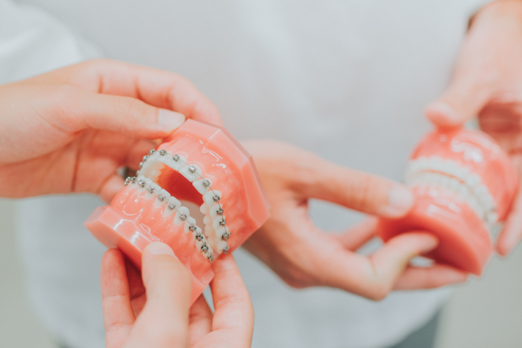 Aparelhos ortodônticos em adultos?