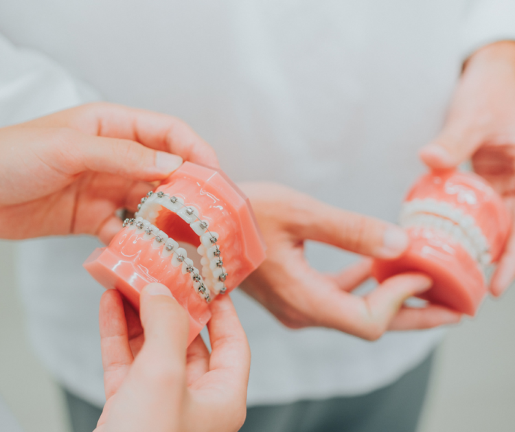 Braces on adult patients? The answer is… yes.