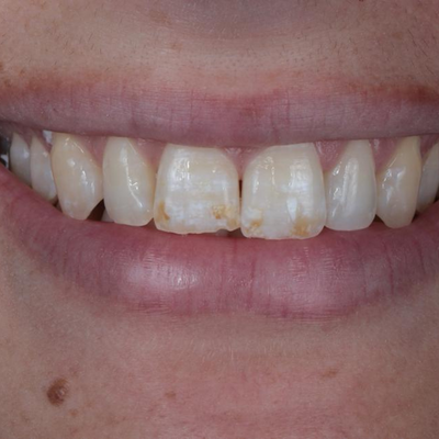 Estética Dentária - Dr. Alex Luz
