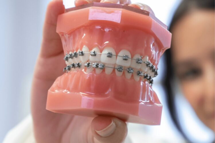 The Importance Of Orthodontics For A Beautiful Smile