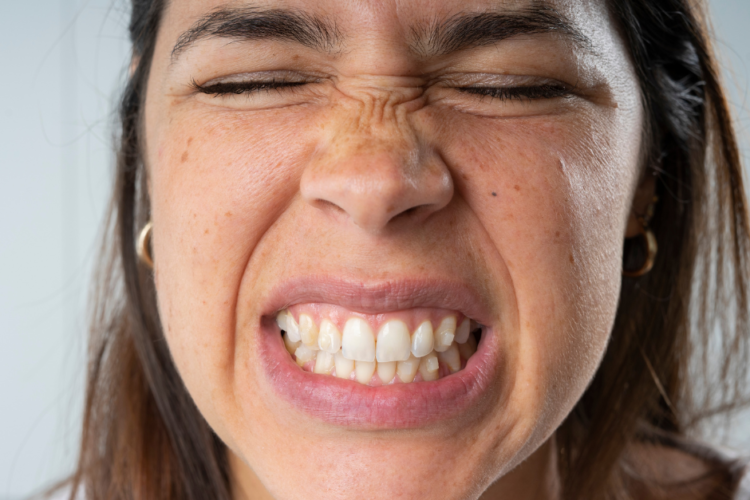 What is bruxism