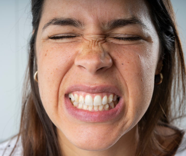 What is bruxism