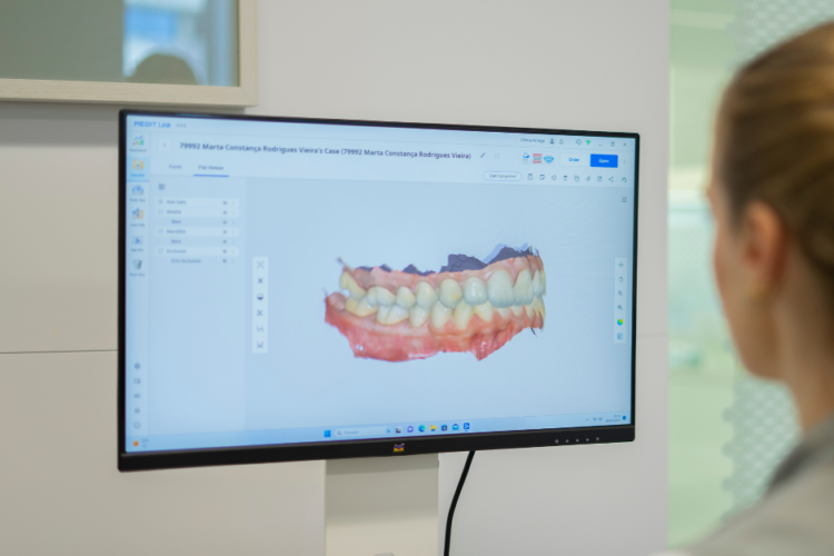 The Intraoral scanner in dentistry
