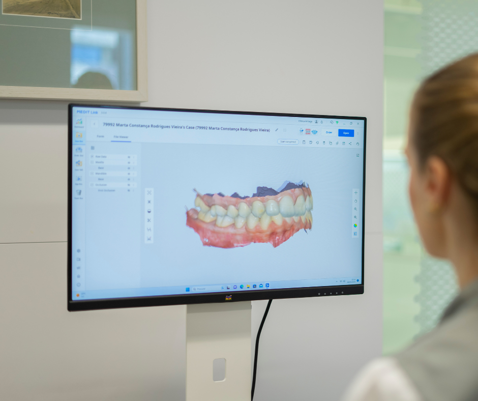 The Intraoral scanner in dentistry