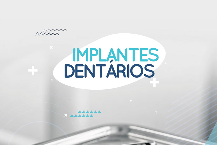 Os implantes dentários são “raízes artificiais” que têm como objetivo a substituição de peças dentárias perdidas.